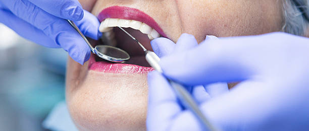 Best After-Hours Dental Trauma Care in Canterwood, WA