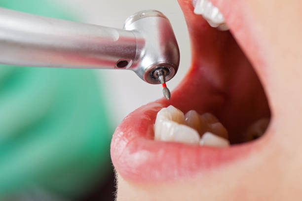 Best Cosmetic Emergency Dentistry in Canterwood, WA